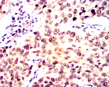 PTPN6 Antibody