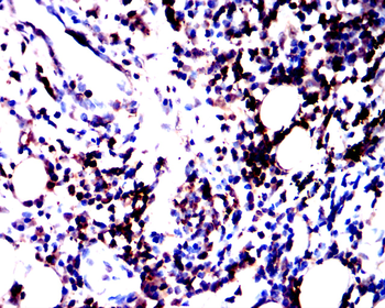 PTPN6 Antibody