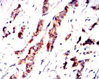 HLA-A Antibody