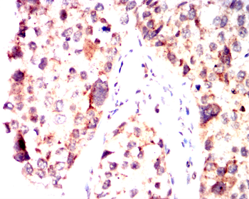 HLA-A Antibody