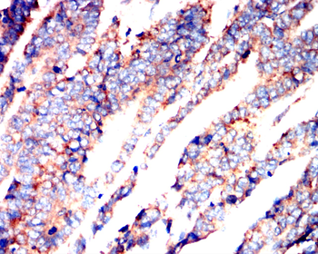 HLA-A Antibody