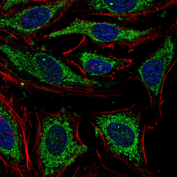 HEXB Antibody