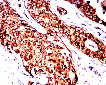 HEXB Antibody