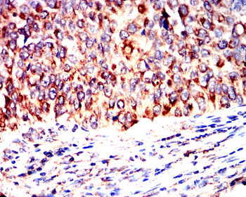 HEXB Antibody