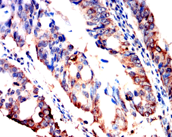 HEXB Antibody