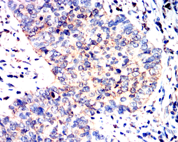 HEXB Antibody