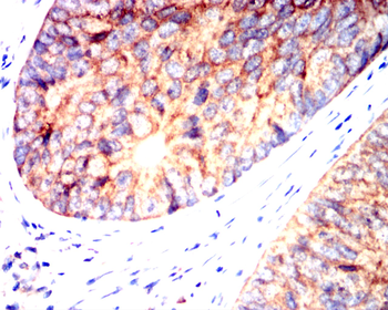 HEXB Antibody