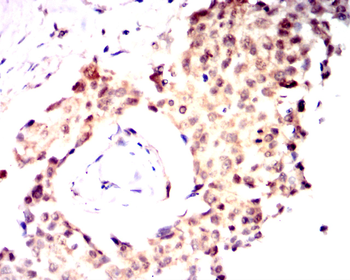 CDK1 Antibody