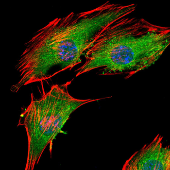 CYP1B1 Antibody