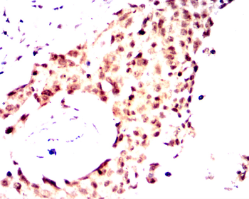 ATF3 Antibody