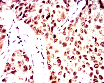 ATF3 Antibody