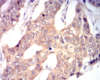 EIF5A Antibody