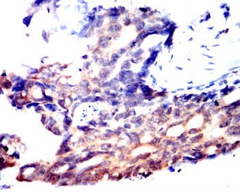 EIF5A Antibody