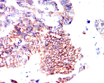 CTNNB1 Antibody