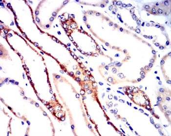 FST Antibody