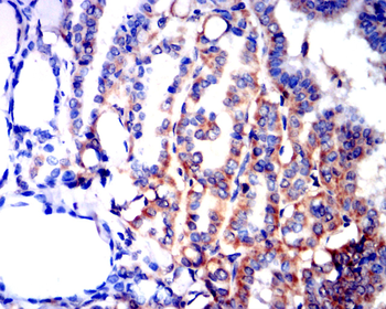 FST Antibody