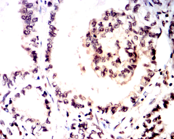 TERT Antibody