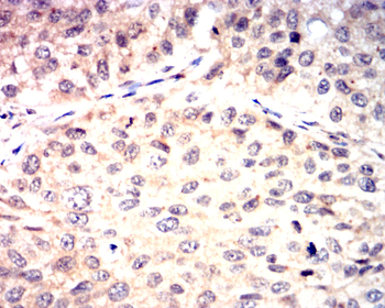 TERT Antibody