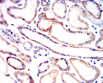 AQP9 Antibody