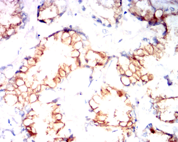 AQP11 Antibody