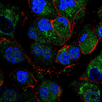 MIP Antibody