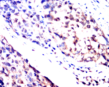 BAK1 Antibody