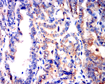 Catenin alpha-1 Antibody