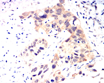 DNMT3A Antibody