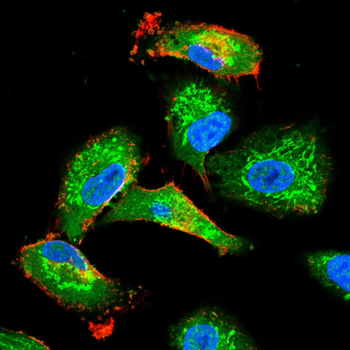 AQP5 Antibody