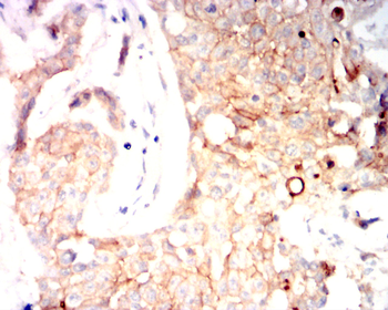 AQP5 Antibody