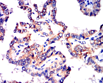 AQP5 Antibody