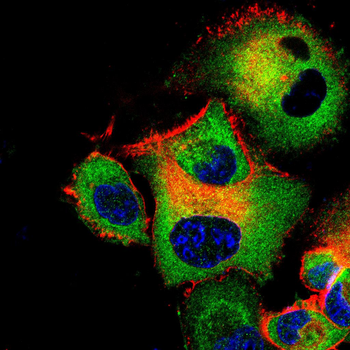 PDGFRA Antibody