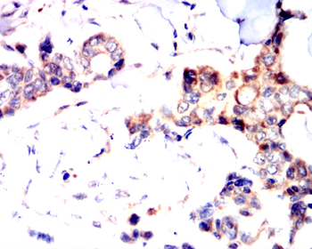 IRAK4 Antibody