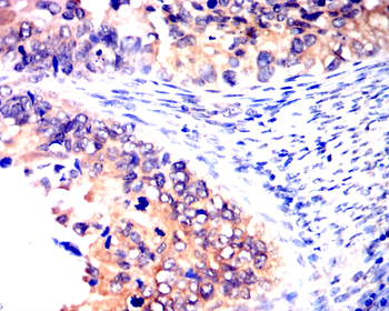 IRAK4 Antibody