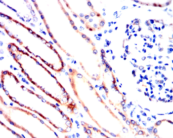 IRAK4 Antibody