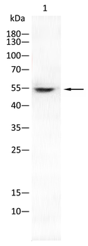 IRAK4 Antibody