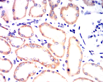 NOS2 Antibody