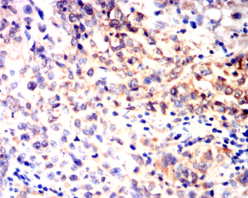 NOS2 Antibody
