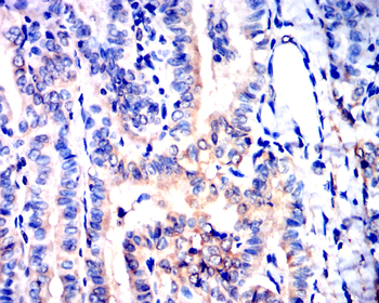 NOS2 Antibody