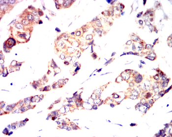 HAS2 Antibody