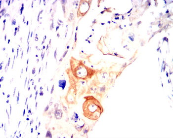 HAS2 Antibody