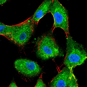 ALPP Antibody