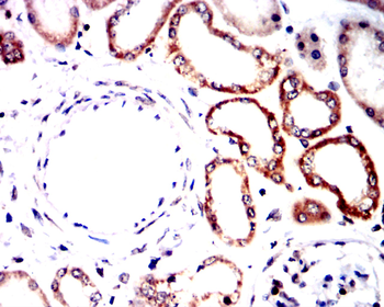 SHH Antibody