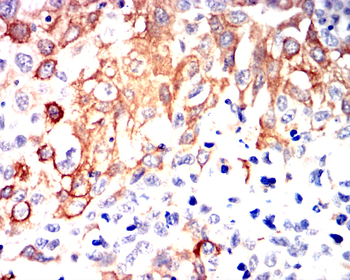 BMPR2 Antibody