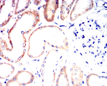 SLC2A4 Antibody