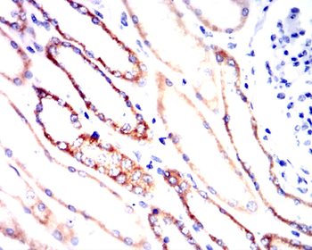 PTPN11 Antibody