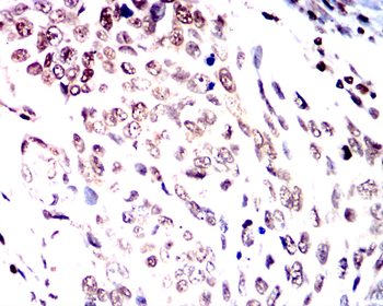 TWIST1 Antibody
