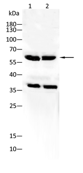 ESR2 Antibody
