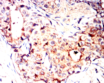 MMP13 Antibody