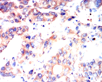 MMP13 Antibody